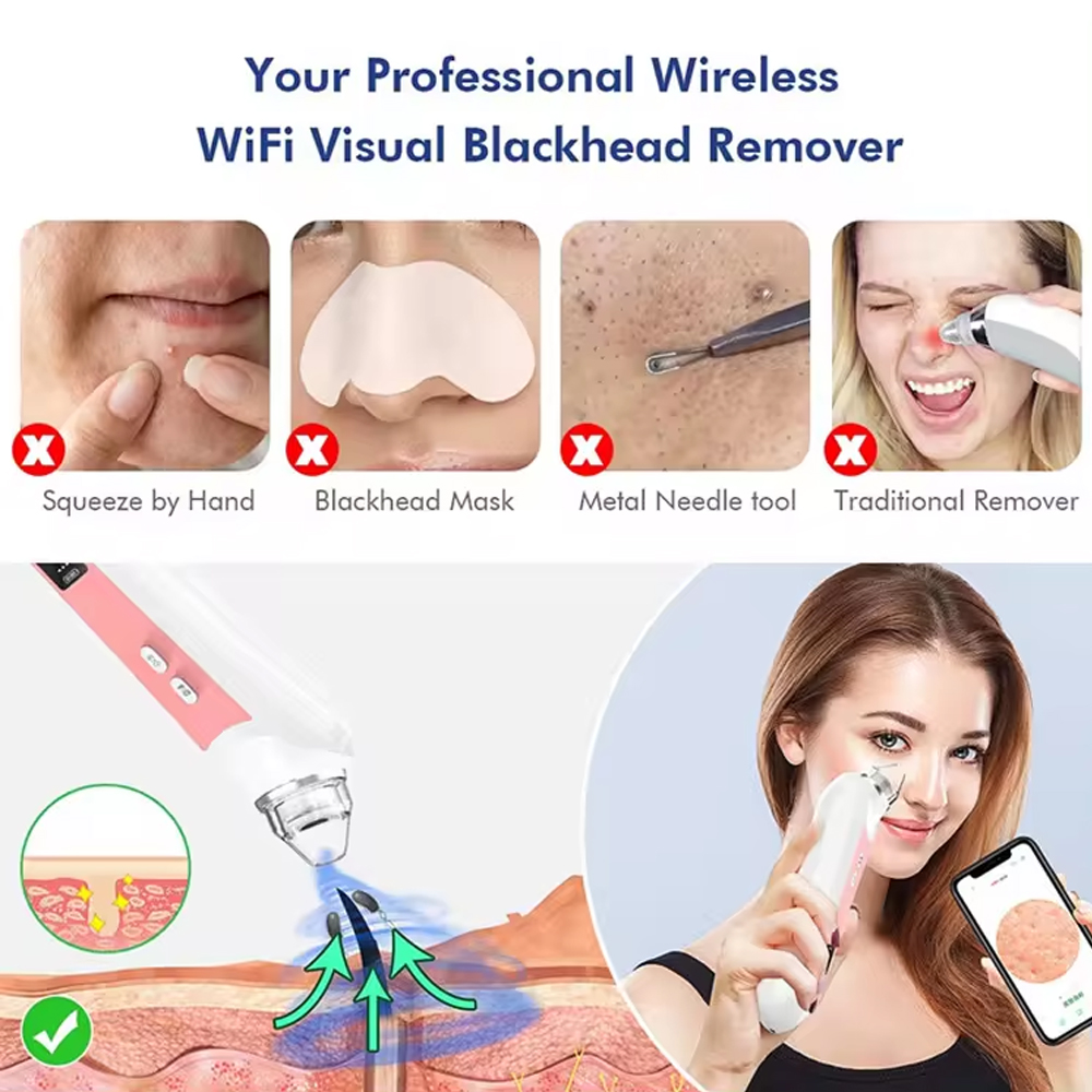 6 Heads Pore Cleaner Blackhead - Pore Vacuum ulasan dan harga