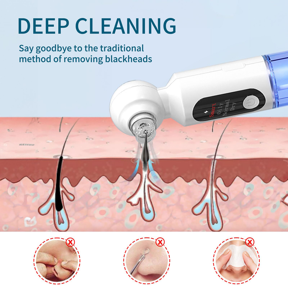 Blackhead Remover Pore Vacuum  - Pore Vacuum ulasan dan harga