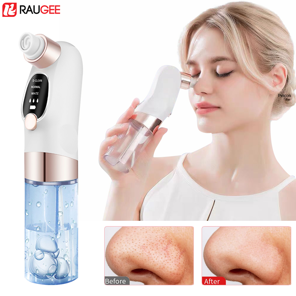 Blackhead Remover Electric Bla - Pore Vacuum ulasan dan harga