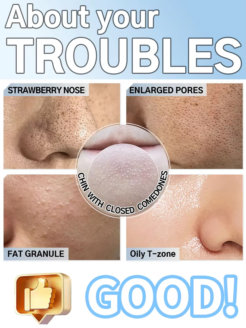 Blackhead Remover Pore Cleaner - Pore Vacuum ulasan dan harga
