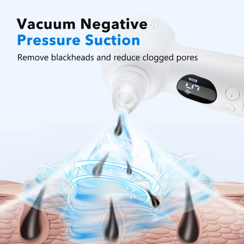 Blackhead Remover Pore Vacuum  - Pore Vacuum ulasan dan harga
