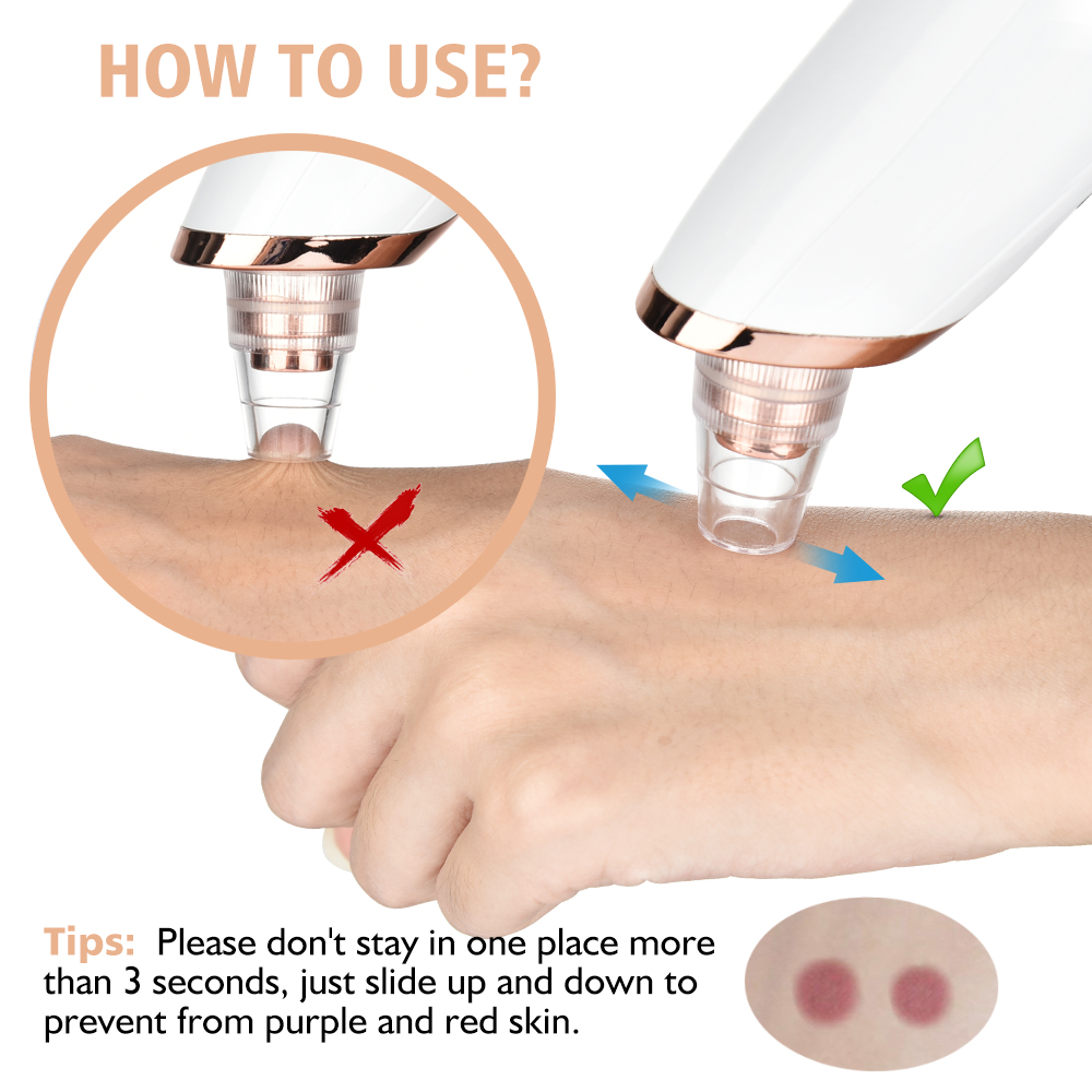 Blackhead Remover Vacuum Pore  - Pore Vacuum ulasan dan harga