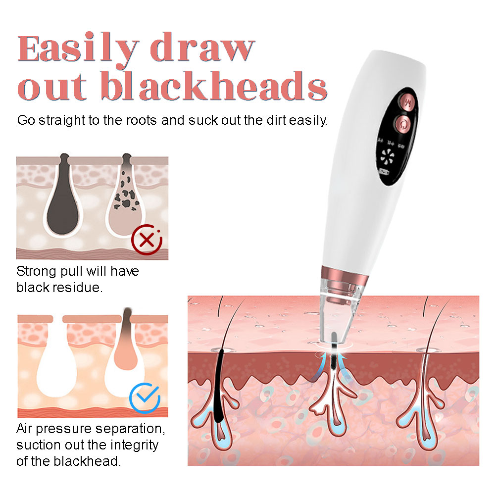 Electric Blackhead Remover Vac - Pore Vacuum ulasan dan harga